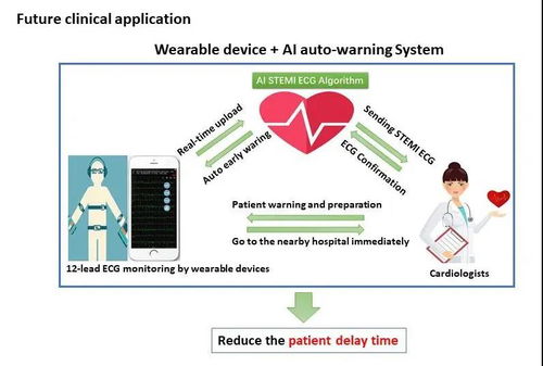 人工智能護航心臟健康 附屬十院徐亞偉團隊研發全球首個心肌梗死人工智能預警系統